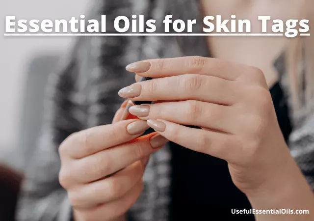 essential oils for skin tags