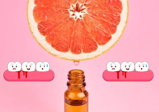 best essential oils for sore gums