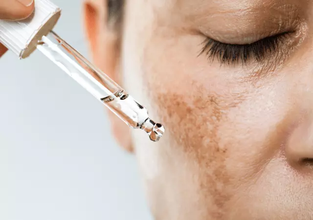 best essential oils for melasma