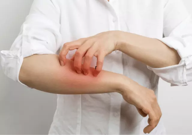 best essential oils for scabies